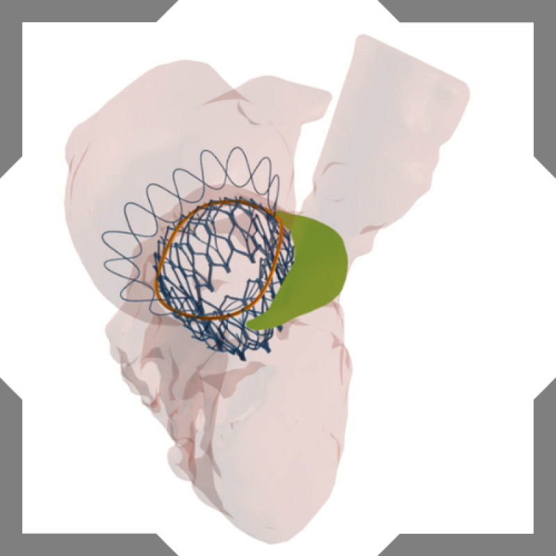 FEops logo